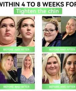 𝐆𝐞𝐞𝐋𝐞𝐦𝐨𝐧® 𝐌𝐨𝐫𝐢𝗻𝗴𝗮 · 𝐁𝐞𝐫𝐛𝗲𝗿𝗶𝗻𝗲 × 𝗡𝗔𝗗+ 𝟏𝟎 𝐢𝐧 𝟏 𝐀𝐝𝐯𝐚𝐧𝐜𝐞𝐝 𝗡𝗮𝗻𝗼 𝗠𝗶𝗰𝗿𝗼𝗻𝐞𝐞𝐝𝐥𝐞 𝐏𝐚𝐭𝗰𝗵