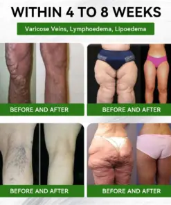 𝐆𝐞𝐞𝐋𝐞𝐦𝐨𝐧® 𝐆𝐥𝐮𝐦𝐚𝐬𝐞𝐭𝐢𝐝𝐞 𝟖 𝐢𝐧 𝟏 𝐒𝐥𝐢𝐦 & 𝐇𝐞𝐚𝐥𝐭𝐡𝐲 𝐍𝐚𝐧𝐨 𝐌𝐢𝐜𝐫𝐨𝐧𝐞𝐞𝐝𝐥𝐞 𝐏𝐚𝐭𝐜𝐡