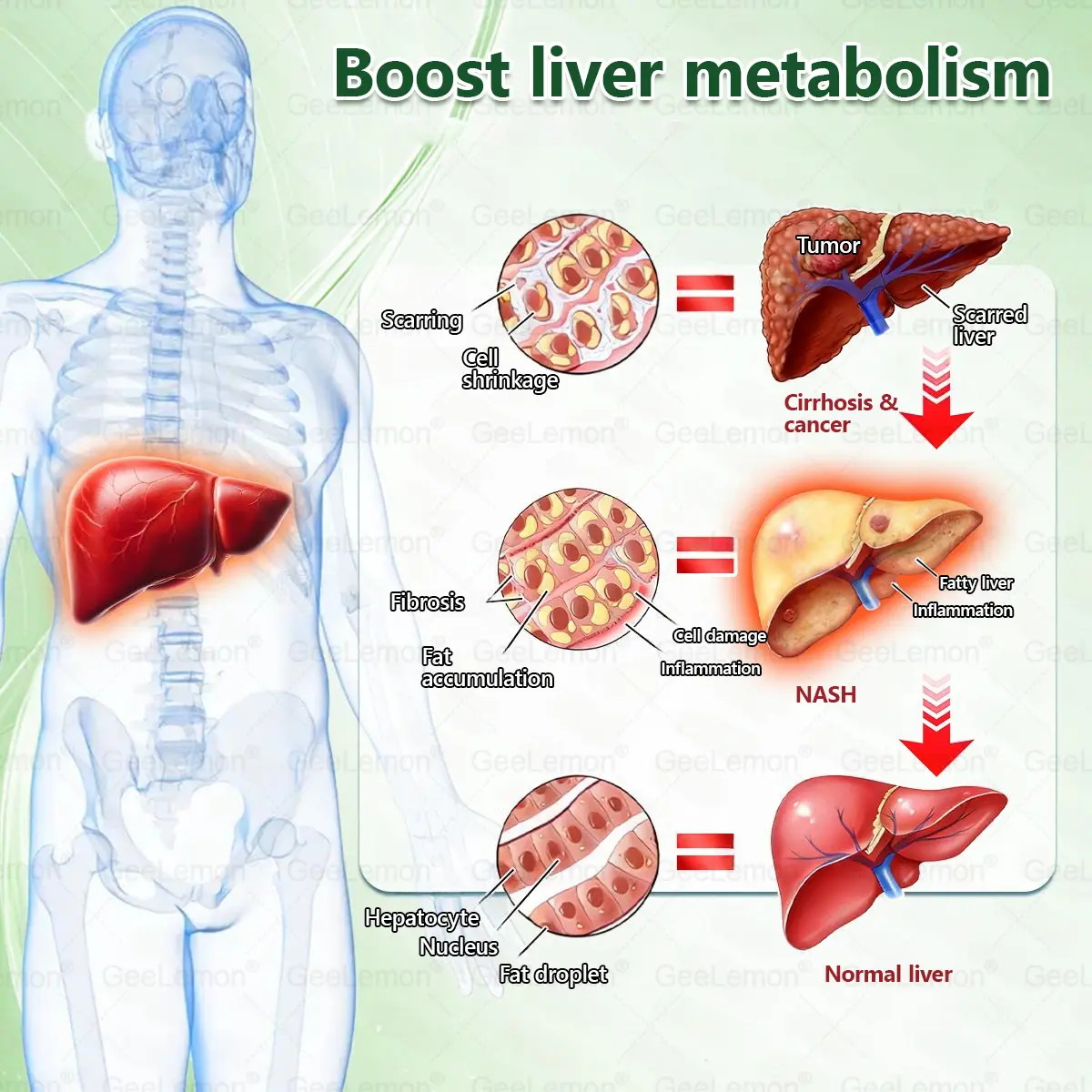 ๐๐๐๐๐๐๐๐ยฎ ๐๐๐๐+๐
๐๐
๐๐ ๐๐๐ซ๐๐๐ฅ ๐๐ข๐จ๐๐จ๐จ๐ฌ๐ญ ๐๐๐ง๐จ ๐๐ข๐๐ซ๐จ๐ง๐๐๐๐ฅ๐ ๐๐๐ญ๐๐ก